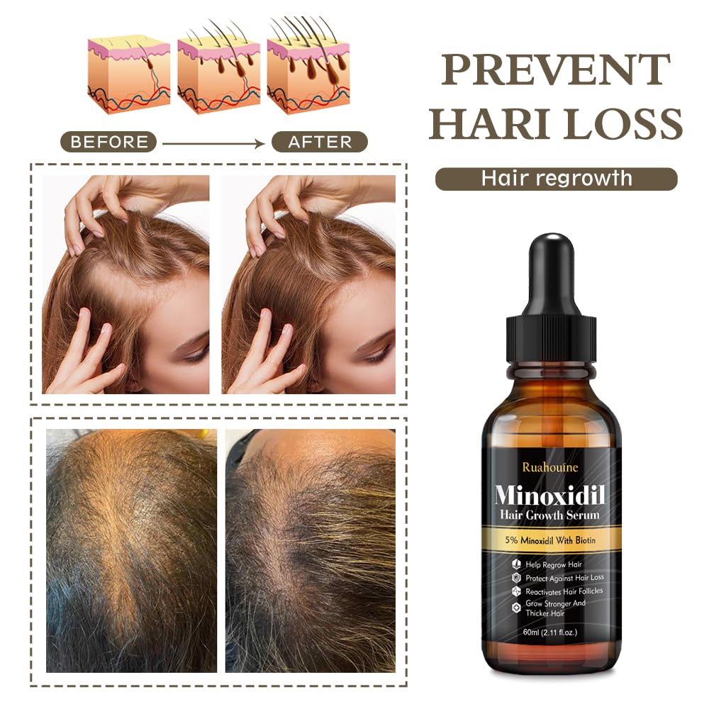 5% Minoxidil Hair Growth Serum Oil 2.11oz Z162421