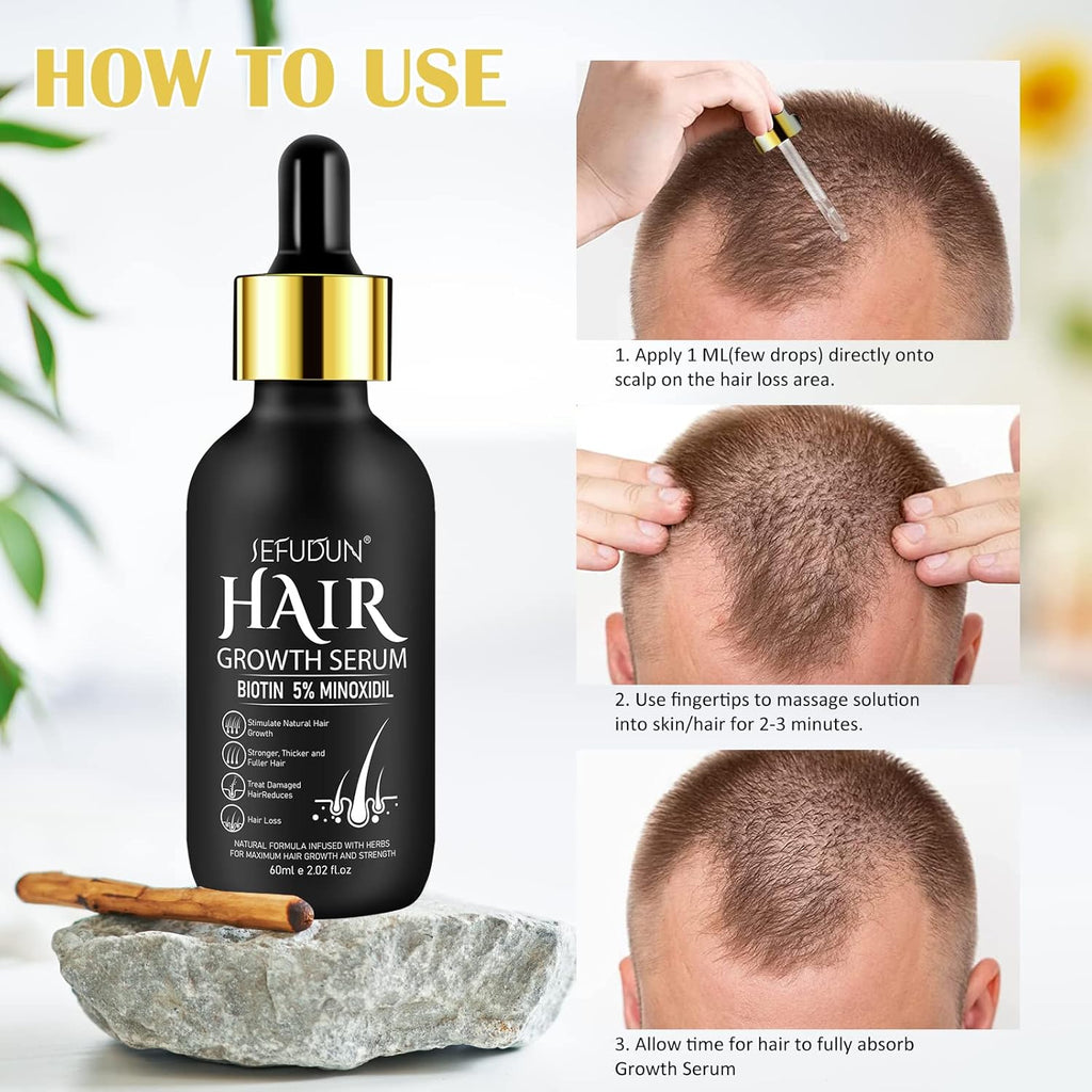 2Pack 5% Minoxidil Hair Growth Serum H9350