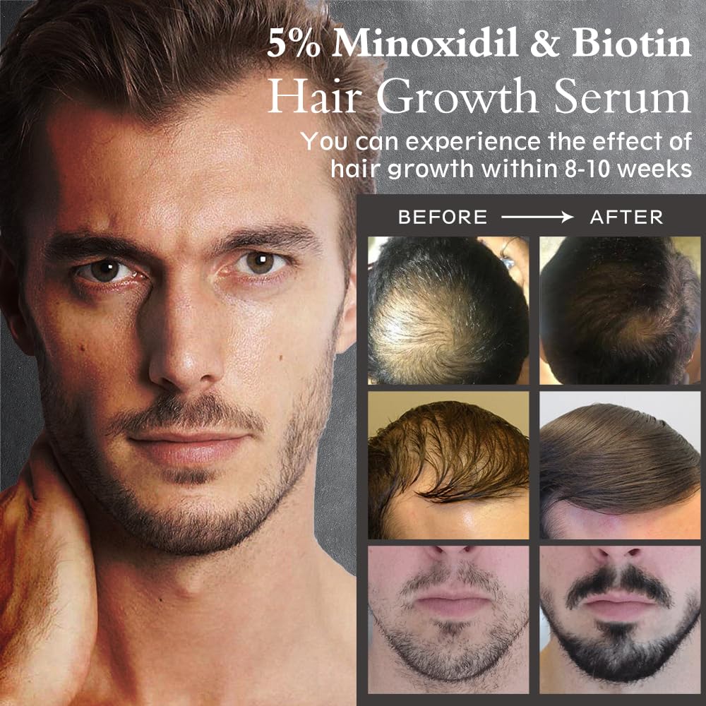 5% Minoxidil Hair Growth Serum Oil 2.11oz Z162421